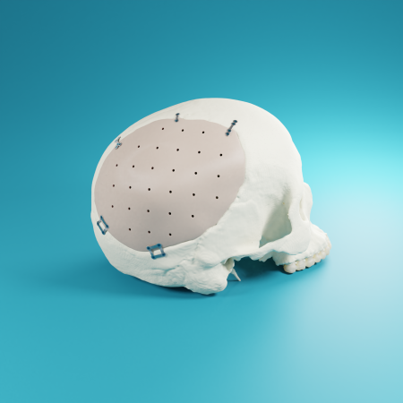 AccuShape®