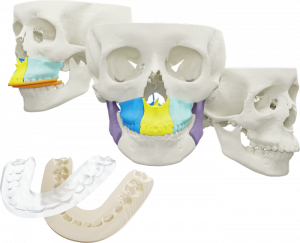 AccuPlan Orthognathic