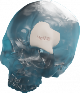 Skull Model