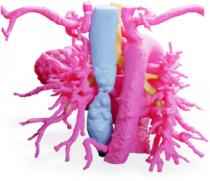 Heart Model