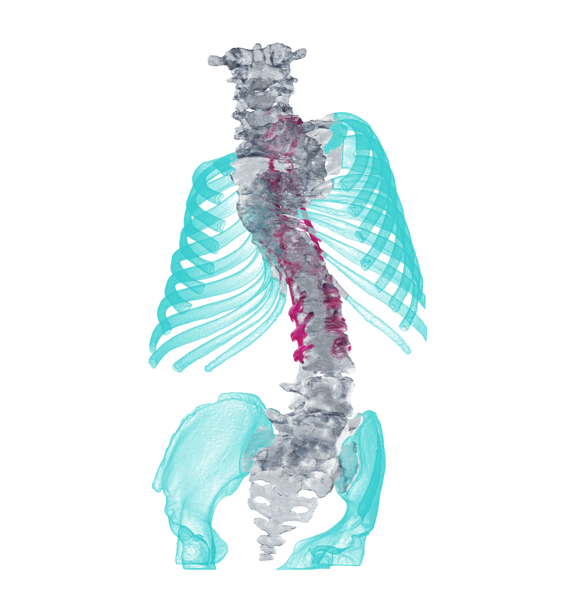 AccuModel